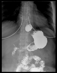 Рентгенологическое исследование желудка