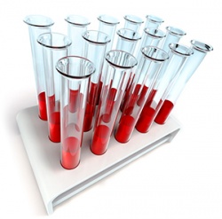 Клиническое биохимическое исследование крови