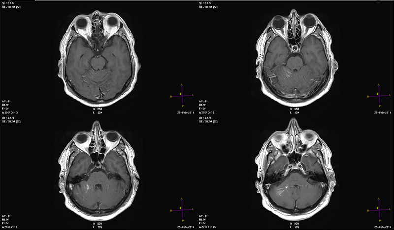 Мрт мозга ульяновске цены. Мрт головного мозга [WL] 2д спектр. Издательство Панфилова лучевая диагностика головной мозг.